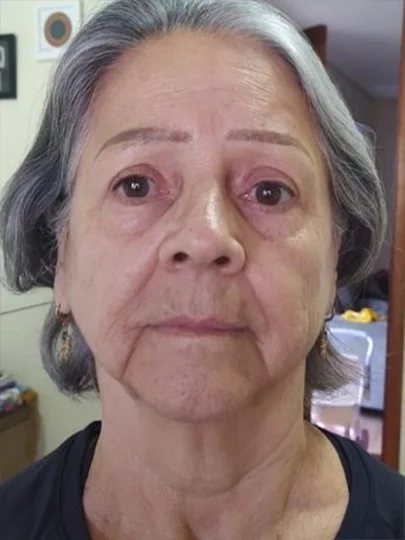 Aluna de 68 anos · 21 dias, antes