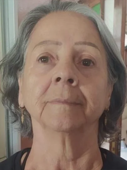 Aluna de 68 anos · 21 dias, depois