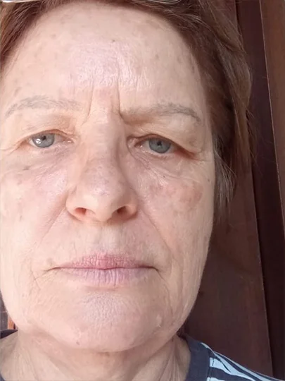Monica, 64 anos · 26 dias, antes