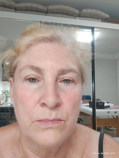 Marlene, 70 anos, antes