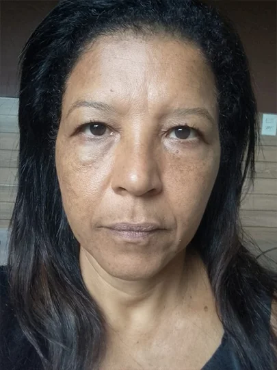 Erlita, 52 anos, antes