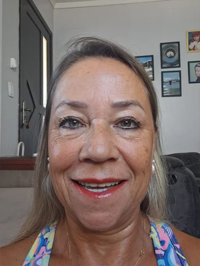 Eliane, 61 anos, depois