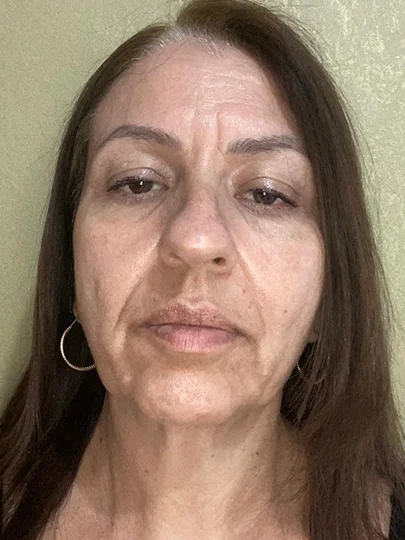 Elisabete, 57 anos, antes