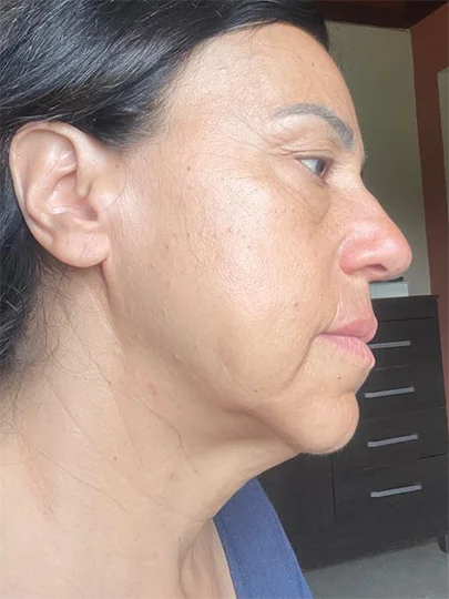Sandra, 58 anos, antes