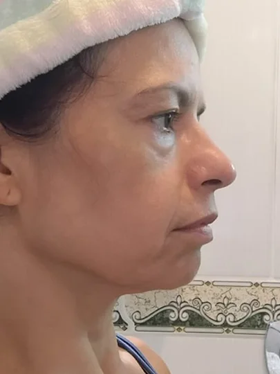 Anaúra, 56 anos, antes