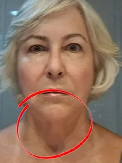 Aluna Xô Rugas, depois