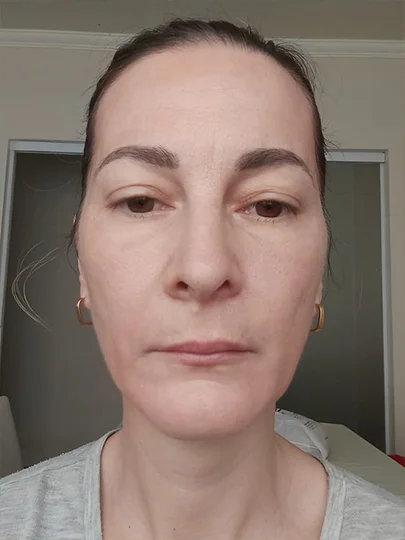 Andrea, 50 anos, depois
