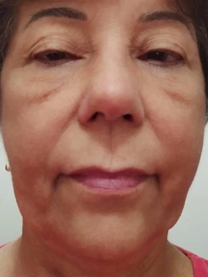 Maria Lucia, 52 anos · 40 dias, antes