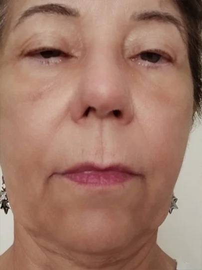 Maria Lucia, 52 anos · 40 dias, depois