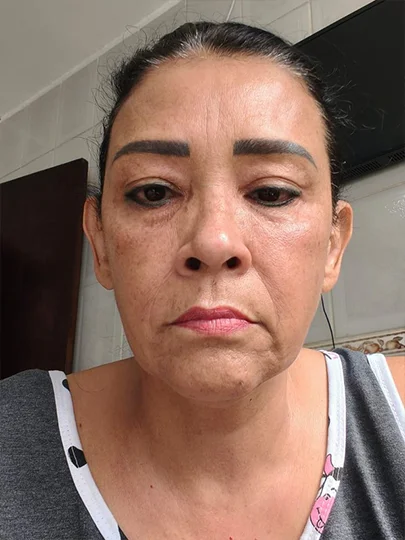 Magali, 53 anos, antes