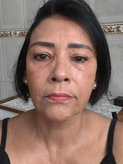 Magali, 53 anos, depois